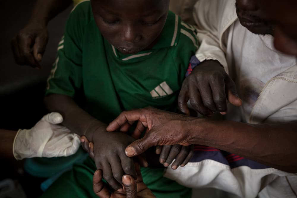 Neglected tropical diseases in 2023